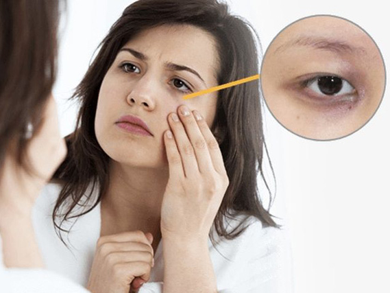 Bất kể nam hay nữ trên cơ thể xuất hiện '2 đen 2 hôi' chứng tỏ suy giảm chức năng thận