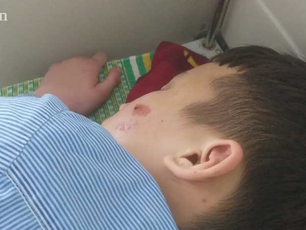 Kinh hoàng lời kể nạn nhân 14 tuổi bị chủ quán bánh xèo 'tra tấn': Bị đánh đập nhiều lần bằng chày đập đá và cạo vảy cá khiến cơ thể thương tích nặng nề, tinh thần hoảng loạn