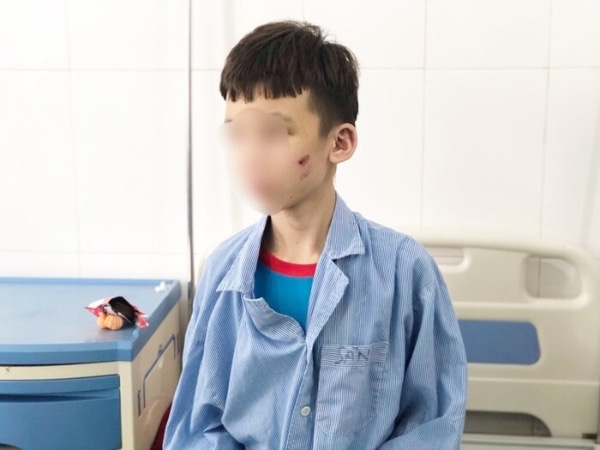Nhân viên 15 tuổi bị chủ quán bánh xèo đánh đập dã man: 'Em kể với anh trai nhưng lại bị anh chửi'