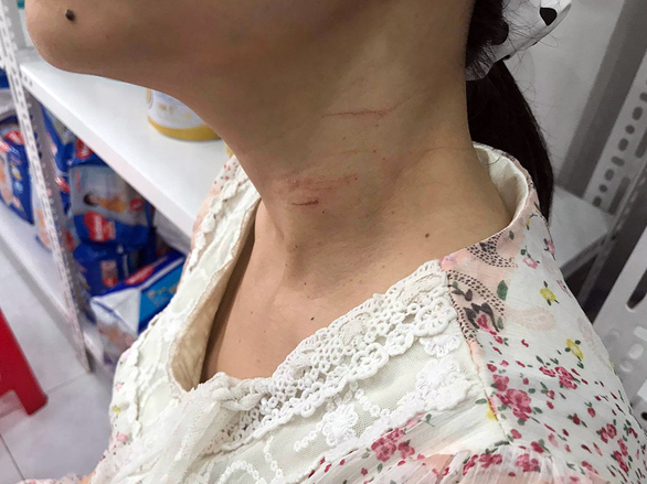 Thai phụ đã nhanh trí khi bị khống chế bằng dao