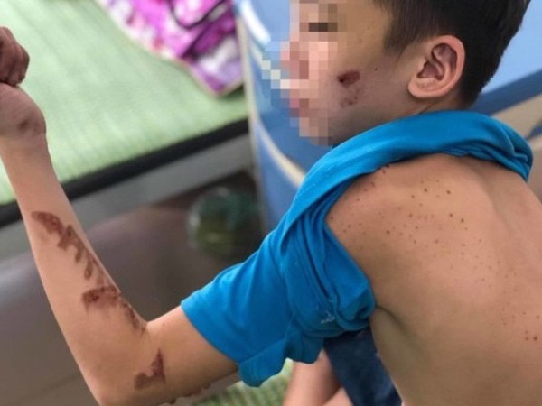 Từ nghi án chủ quán bánh xèo bạo hành nhân viên: Người nuôi con nhỏ dưới 36 tháng có bị xử lý hình sự?