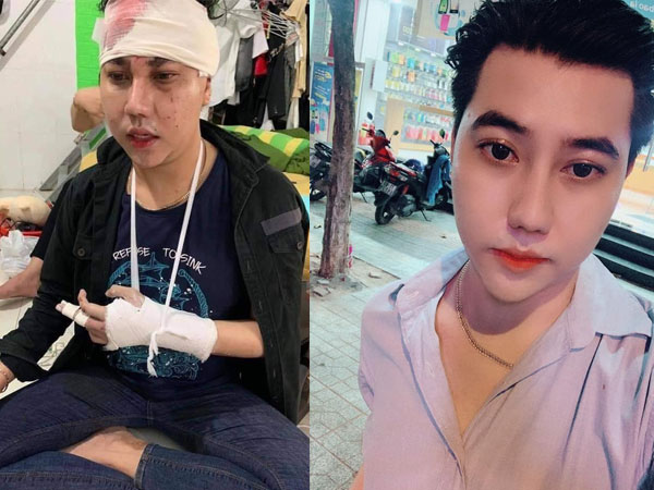 Nghi bị đánh bầm dập do làm clip cà khịa, thánh xịt nước hoa 'chịu không chịu thì thôi' nói gì?
