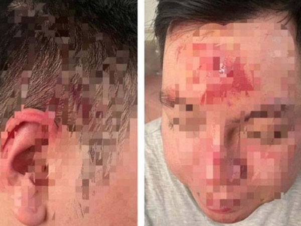 Làm rõ vụ nhân viên quán bar đánh khách vì mời rượu không uống