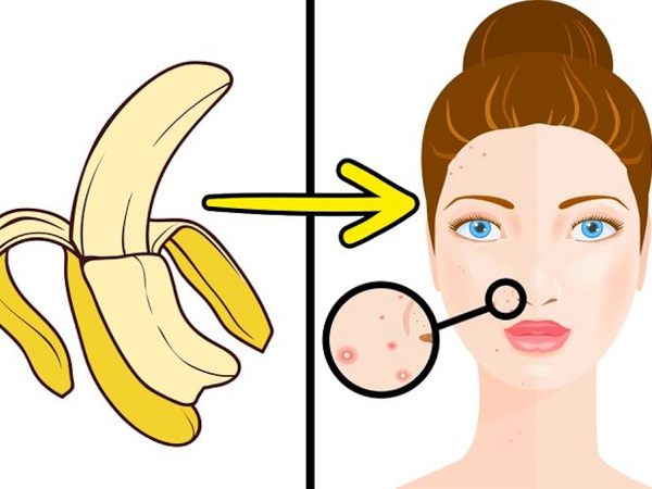 6 công dụng làm đẹp bất ngờ của vỏ chuối