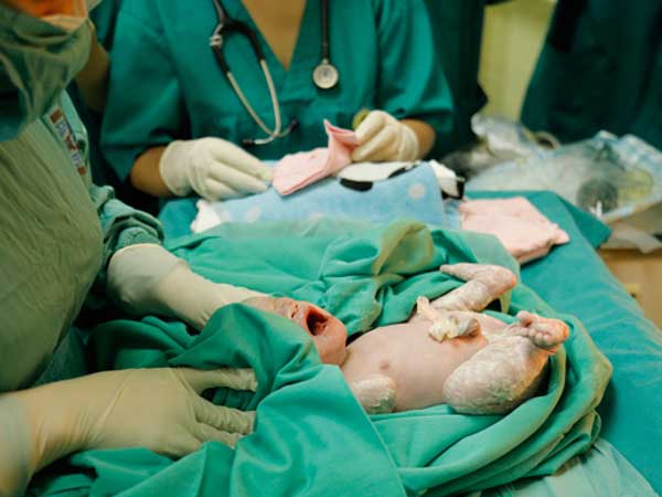 Mổ ngồi bắt con cho cô gái trẻ mắc ung thư ngủ gục