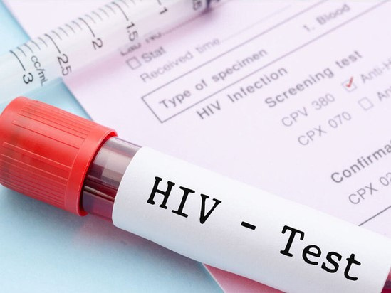 Vì sao độ tuổi được xét nghiệm HIV tự nguyện giảm xuống đủ 15 tuổi?