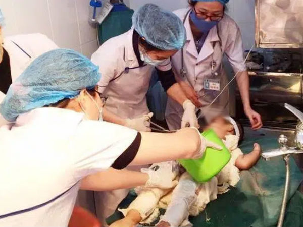 Cháu bé hơn 2 tuổi bị nhiễm trùng nặng vì chữa bỏng bằng nước mắm và rượu