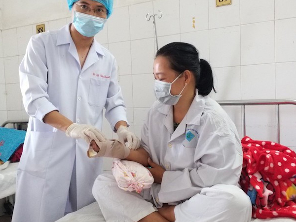 Xay cá làm chả, người phụ nữ bị cuốn nát bàn tay