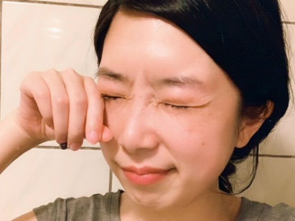 Cô gái đến khám trong tình trạng không thể mở mắt, bác sĩ cảnh báo do thói quen trang điểm mà nhiều chị em mắc phải