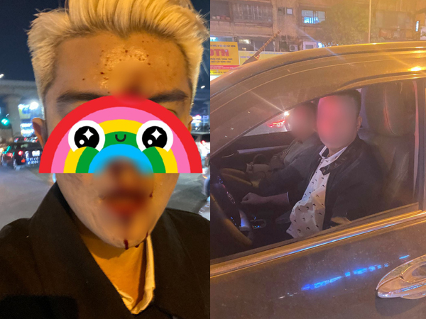 Hà Nội: Xôn xao nam thanh niên bị đánh gãy răng, chảy máu mũi do nhắc nhở tài xế dừng xe quá lâu gây tắc đường
