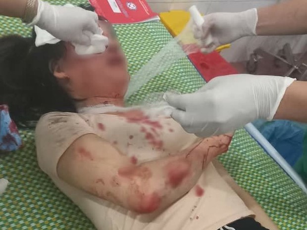 Cô gái bị cướp giật túi xách và kéo lê gần 30m trầy xước khắp mặt mũi