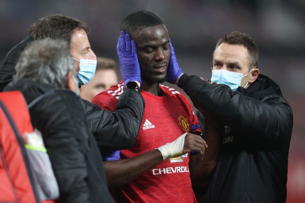 MU vắng 4 trụ cột trước trận đá bù với Burnley