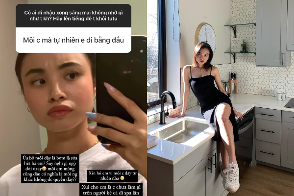 Gái xinh nổi tiếng với loạt vlog trong ô tô 'phản dame' cực gắt trước nghi vấn dao kéo: 'Môi dày là bơm hay sửa hết hả?'