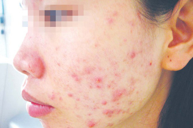 Sát Tết, lại khổ vì mỹ phẩm giả