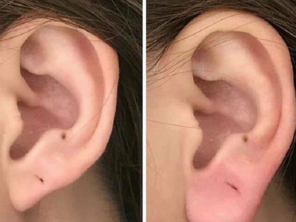 Rộ trào lưu làm tai tài lộc mong thay đổi vận mệnh, chuyên gia cảnh báo: Cẩn thận nát tai