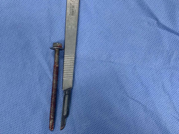Người đàn ông đến bệnh viện với chiếc ốc vít dài 6cm xoáy vào giữa dương vật