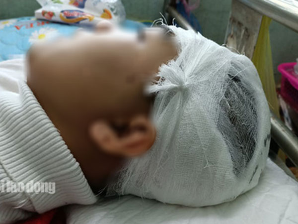 Vụ nam sinh lớp 11 bị đánh vỡ sọ não: Công an huyện nói gì?