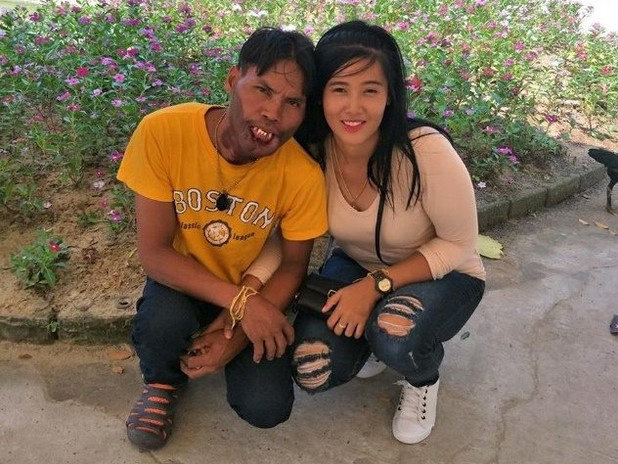 Chàng trai 'mặt quỷ' nên duyên, thề non hẹn biển với người vợ xinh đẹp giờ có cuộc sống ra sao sau 2 năm?
