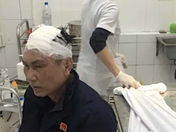 Hà Nội: Bảo vệ chung cư bị đánh cháy máu đầu vì 40.000 đồng tiền vé vào cửa