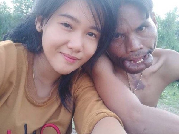 Cuộc hôn nhân không như mơ của chàng trai 'mặt quỷ' và 'vợ tiên'