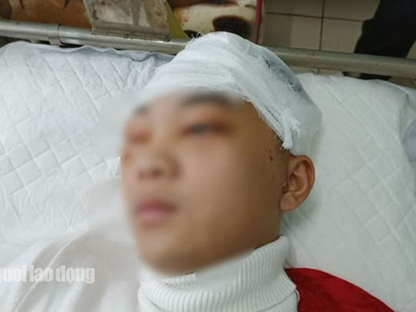 Nam sinh lớp 11 bị đánh vỡ sọ não chuyển viện tiếp tục điều trị