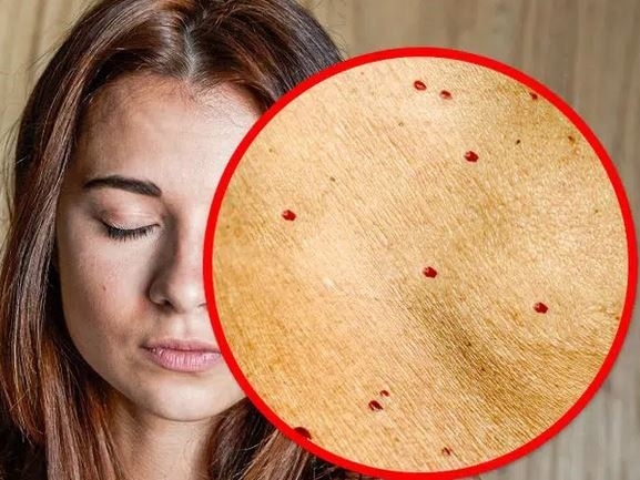 Đang ở độ tuổi đôi mươi mà thấy 8 dấu hiệu trên khuôn mặt thì hãy coi chừng bạn đang bắt đầu già đi nhanh chóng