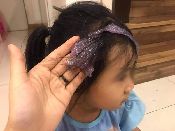 Bé gái nghịch dại khiến 'chất nhầy ma quái' ôm trọn mái tóc, mẹ trẻ vội vàng lên mạng cầu cứu cách loại bỏ và nhận về 1 rổ kinh nghiệm