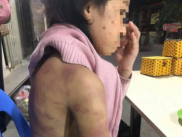 Hà Nội: Bố bàng hoàng khi biết con gái 12 tuổi nghi bị mẹ bạo hành, người tình của mẹ xâm hại nhiều lần