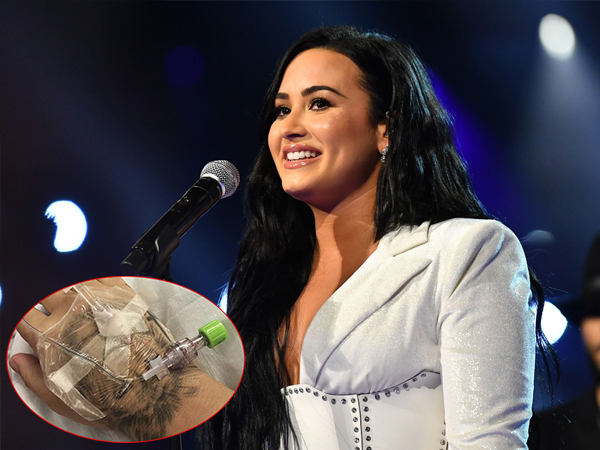 Hậu dùng ma túy quá liều, Demi Lovato tiết lộ biến chứng gây sốc: 3 lần đột quỵ suýt chết, não hư hại, mắt có điểm mù