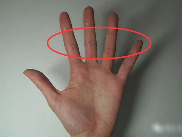 Những người gan tốt thường không có 3 biểu hiện này trên tay, kiểm tra ngay để nắm được tình hình sức khỏe