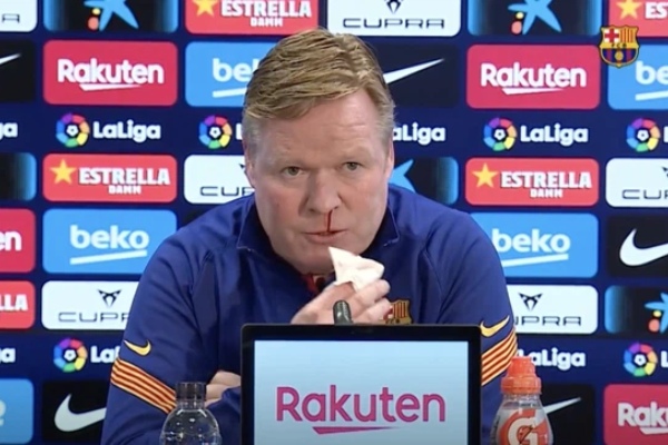 HLV Koeman chảy máu mũi giữa buổi họp báo, CĐV Barca lo lắng