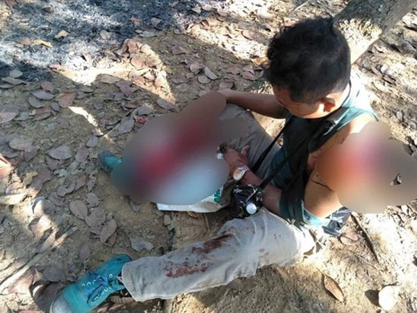 Kinh hãi người đàn ông bị bò tót húc nát vai và chân