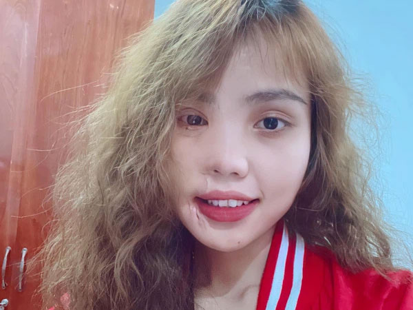Cô gái bị chồng sắp cưới tạt axit xuất hiện với tạo hình mới lạ trong bộ ảnh đậm chất nghệ thuật