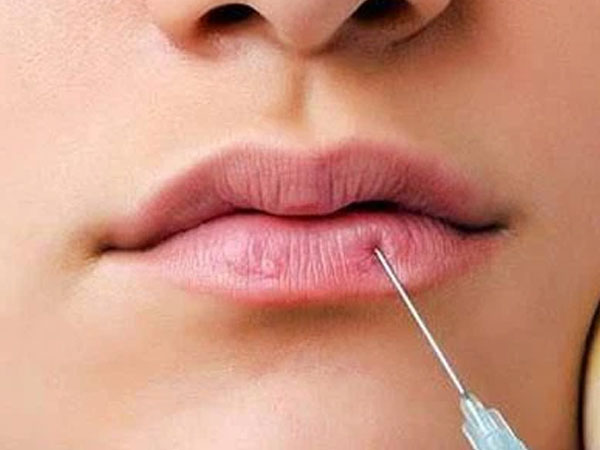 Ngoài tiêm filler và tế bào tự thân, chuyên gia 'bật mí' phương pháp có ưu điểm vượt trội, kéo dài sự trẻ trung hàng chục năm