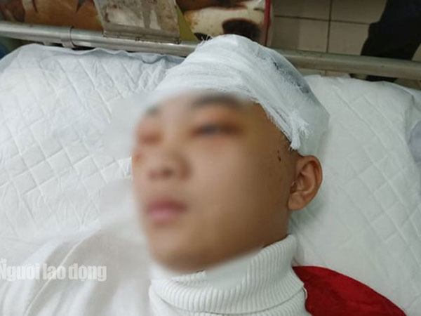 Khởi tố, bắt giam nam sinh lớp 11 đánh bạn học vỡ sọ não