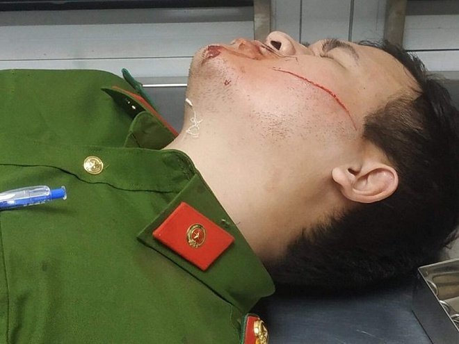 Hai chiến sĩ công an bị chém khi khống chế đối tượng dọa giết người