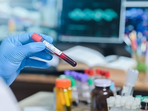 Phát hiện người thứ hai tự khỏi HIV