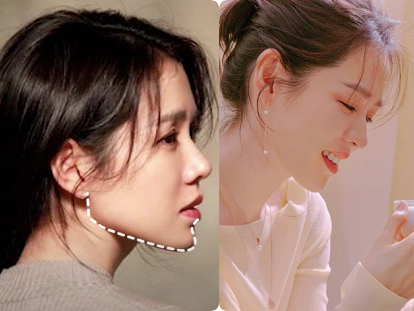 3 lý do khiến Son Ye Jin không thể để tóc ngắn: Tưởng nhan sắc của 'chị đẹp' có thể cân mọi kiểu tóc, hóa ra không phải