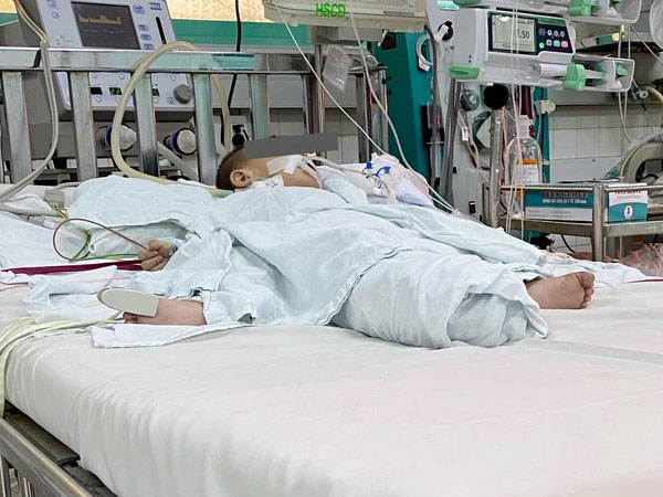 Bố mẹ bất cẩn, con trai 13 tháng tuổi uống nhầm dầu thắp đèn gây tổn thương phổi nặng nề, nguy kịch
