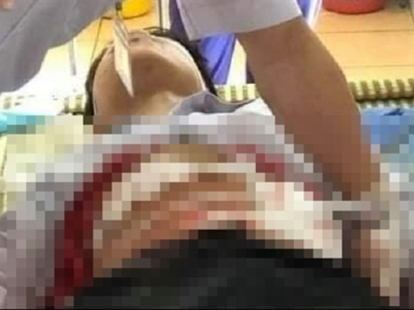 Xô xát trong lúc trêu đùa, nam sinh lớp 9 đâm bạn trọng thương