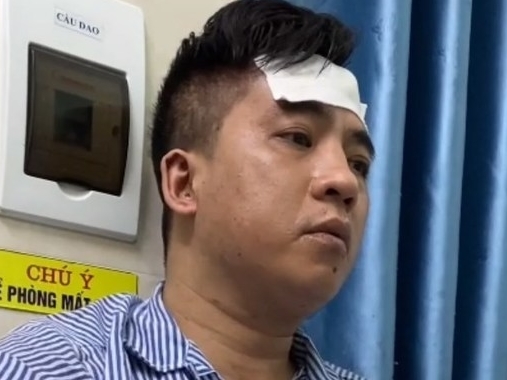 Bắt nghi can giết người tình trong khách sạn