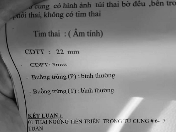 Nữ ca sĩ Việt mang thai lần 4, siêu âm tận 5 lần vẫn không thấy tim thai, đau xót nhắn nhủ: 'Ở với mẹ hết hôm nay, mai hãy về thiên đàng con nhé!'