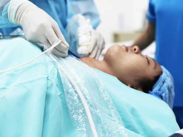 Chữa bướu cổ bằng cách đắp lá, người phụ nữ bị hoại tử, bong tróc da