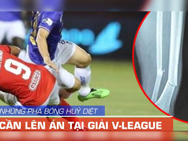 Video những pha bóng huỷ diệt cần lên án tại V-League