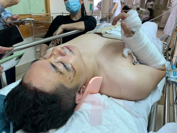 Nạn nhân gãy xương sống vụ 'chung cư thủng' ở Hà Nội kể lại giây phút kinh hoàng: 'Đầu tôi bị đập vào cửa kính tầng 1,  cố đứng dậy nhưng ngã xuống bất tỉnh'