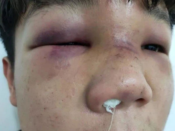 Thái Nguyên: Học sinh mâu thuẫn, phụ huynh hành hung bạn của con