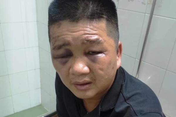 Rút tiền bỏ vào cốp xe, chủ nhà hàng gặp phải 'bọn ác'