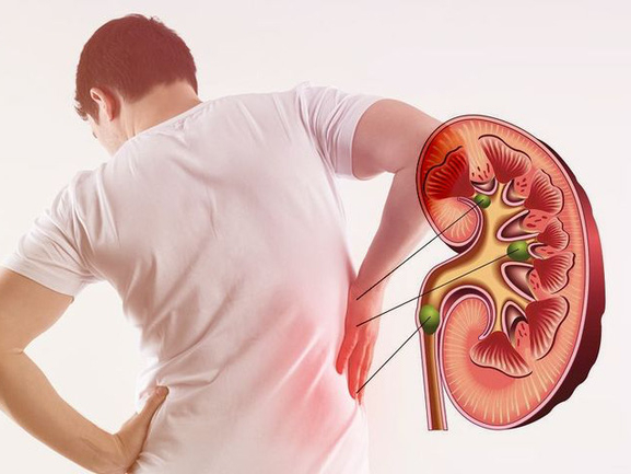 Phát hiện thay đổi rõ ràng ở 4 bộ phận này trên cơ thể, nên đi kiểm tra thận gấp