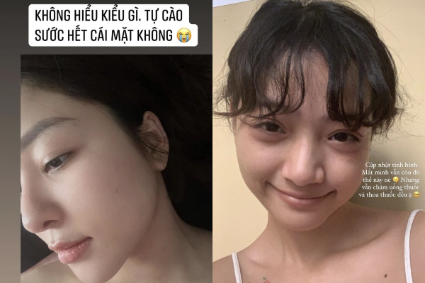 Hội gái xinh tự bóc mặt mộc của chính mình, ai không 'sống ảo' là biết liền