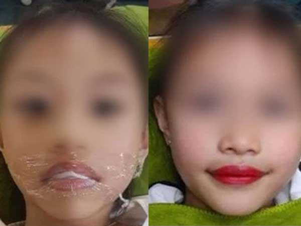 Đại diện thẩm mỹ viện phun môi cho bé gái 5 tuổi lên tiếng: 'Con gái là ngọc ngà trong nhà nên đâu có chuyện làm những gì không tốt cho bé'
